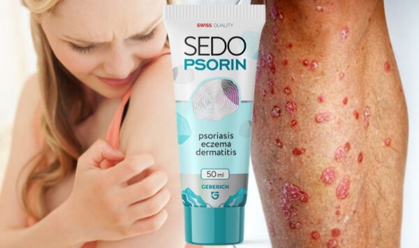 SedoPsorin Crema Italia - Prezzo Recensioni Foro