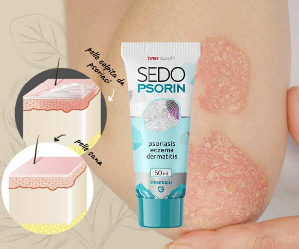 Prezzo di Sedopsorin in Italia e dove acquistarlo - Ordina Prezzo di Sedopsorin in Italia e dove acquistarlo - Ordina