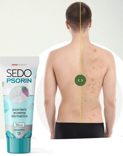 Composizione e ingredienti: cosa contiene? Composizione e ingredienti: cosa contiene?