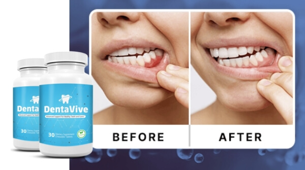 Come si usa Dentavive Come si usa Dentavive